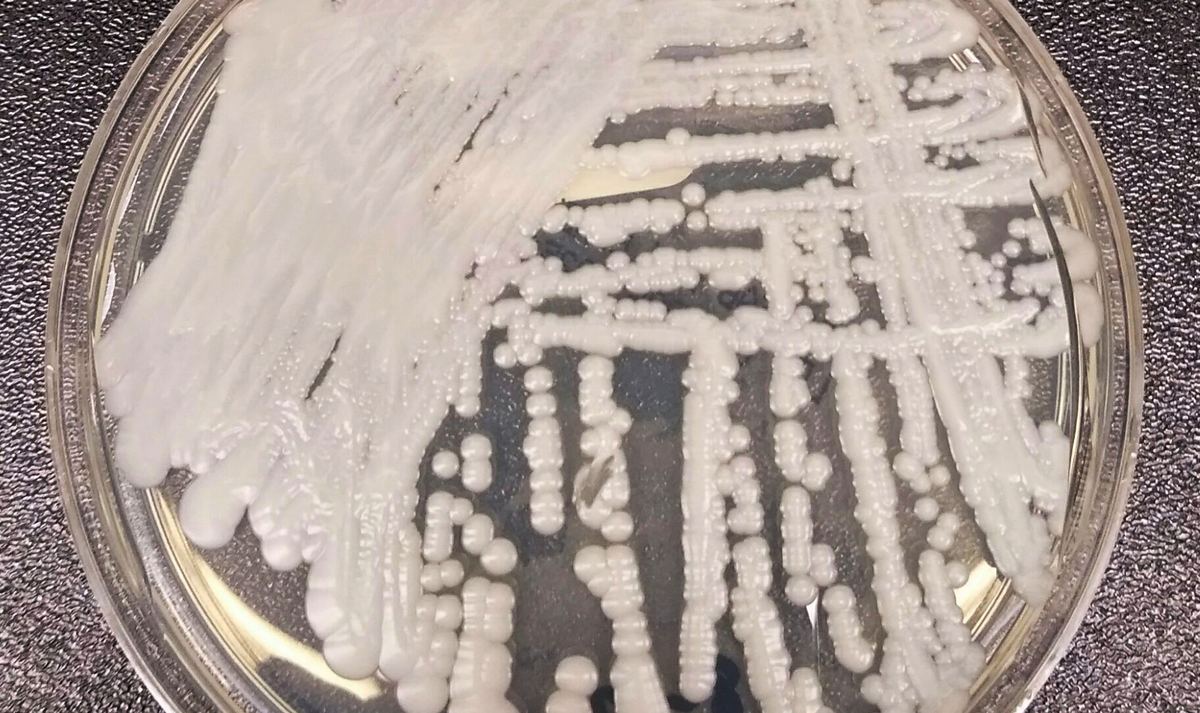 Candida auris Is Now in at Least 23 States &mdash; but If You Are Not in a Hospital, It Is Almost Certainly Not About You